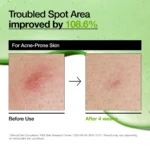 ⁦سيروم تهدئة الاحمرار أزيليك أسيد 10 % + هيالورون⁩ - الصورة ⁦3⁩